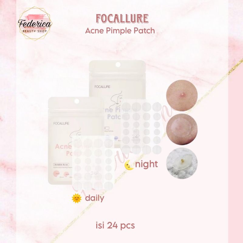 Focallure Acne Pimple Patch / Stiker Jerawat