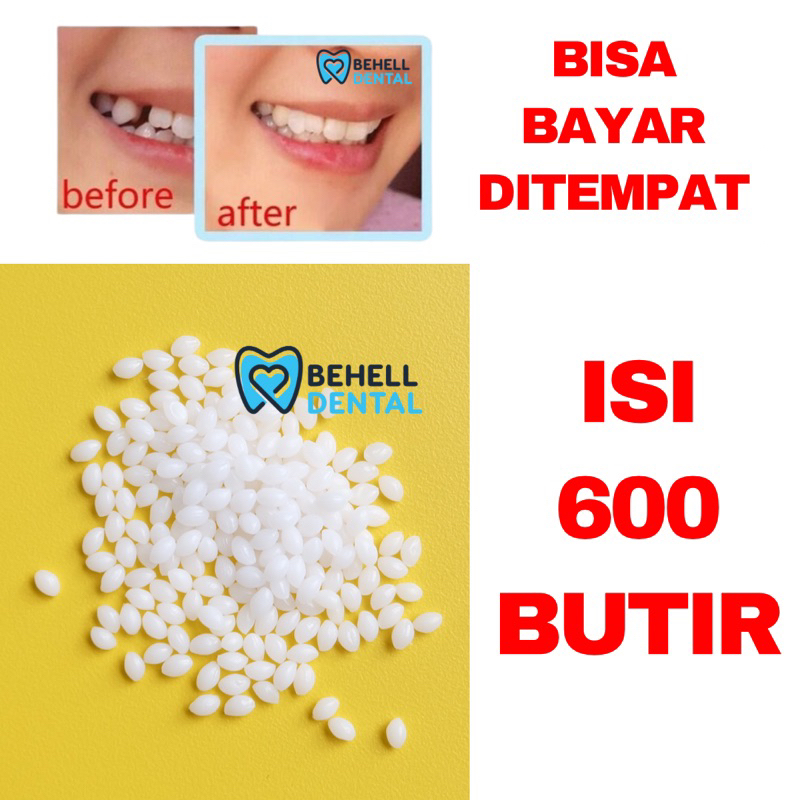 TERMURAH ! 600 BUTIR GIGI PALSU TEMPTOOTH PENAMBAL TAMBALAN GIGI PATAH RENGGANG TEMPORARY TOOTH TEMPTOOTH GINGSUL PATAH SEMENTARA - LEM GIGI TIRUAN DENTAL SOLID  ORTHO - 200 BUTIR / 100 BUTIR / 600 BUTIR - BEHELLDENTAL ORIGINAL