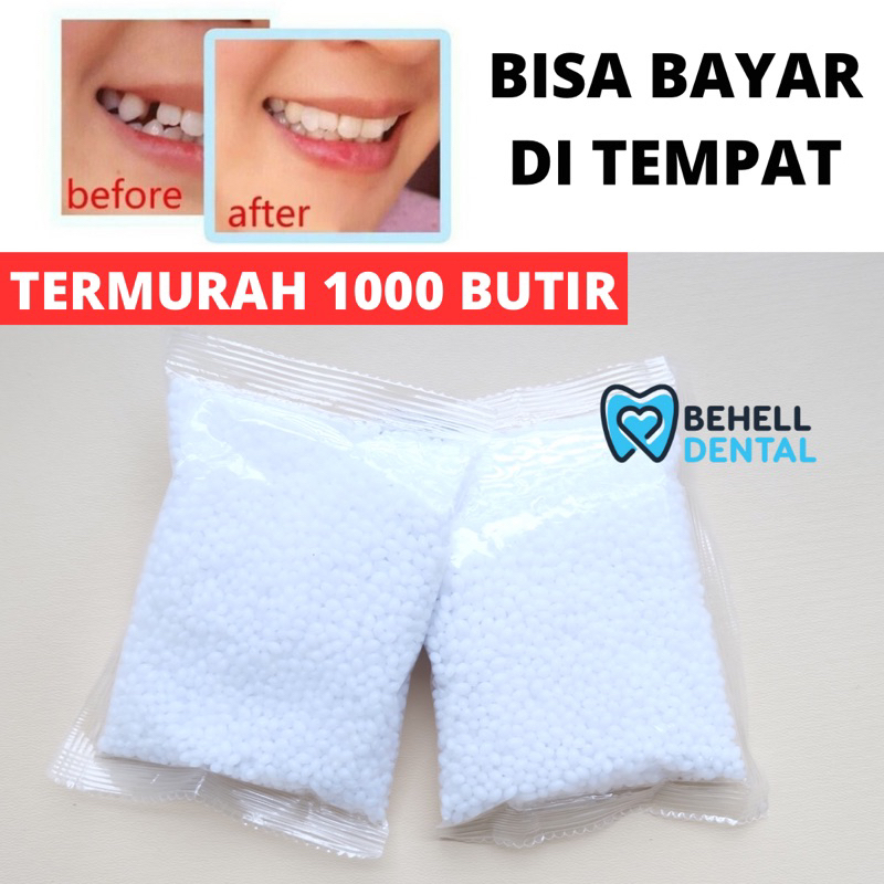 TERMURAH !! 1000 BUTIR TEMPTOOTH GIGI PALSU SEMENTARA PENAMBAL GIGI PATAH RENGGANG / TEMTOOTH / BAHAN TAMBAL GIGI BOLONG BERLUBANG / TEMPORARY TOOTH INSTAN PRAKTIS / TEMPTOOTH GINGSUL PATAH LEM TIRUAN MURAH ORIGINAL ISI 200 / 500 / 400 / 150 / 100 BUTIR