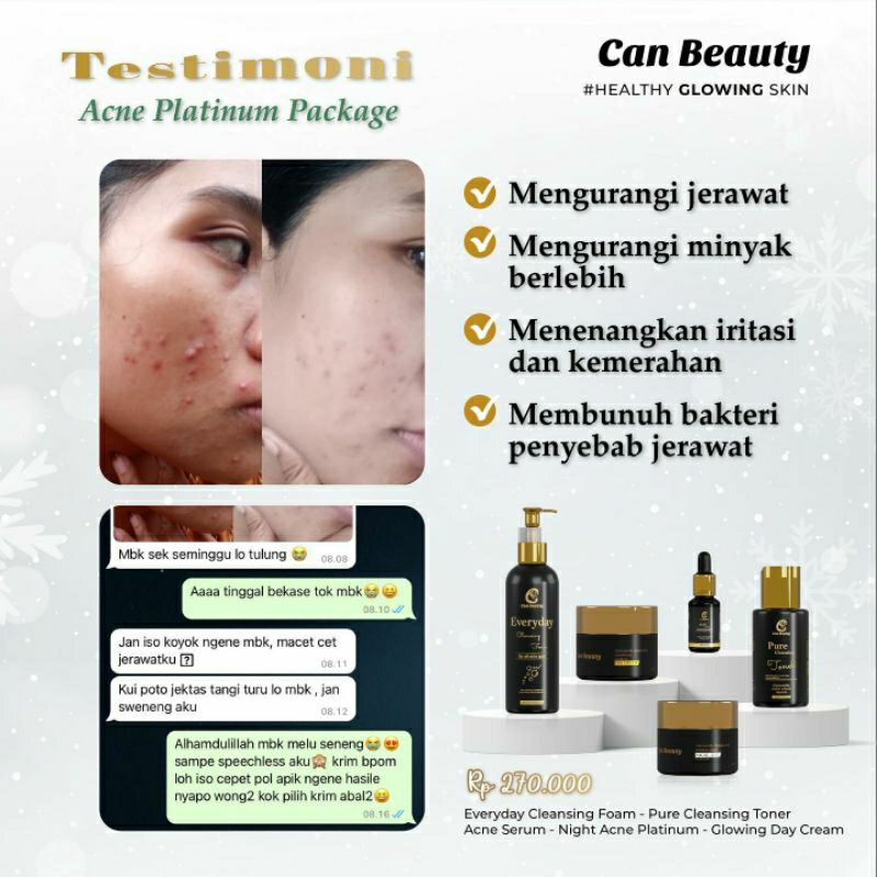 can beauty acne paket can beauty paket wajah acne series