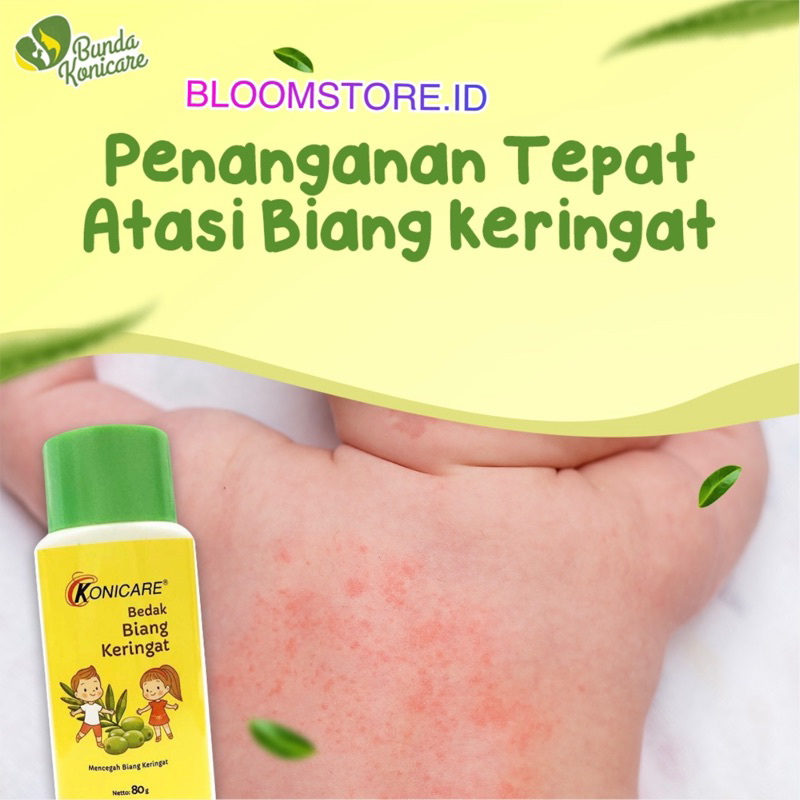 KONICARE Bedak Biang Keringat Bayi 80 100 g gr gram 100g 100gr 100gram 80g 80gr 80gram 80+20gr 80+20 + 20 Original Murah Termurah