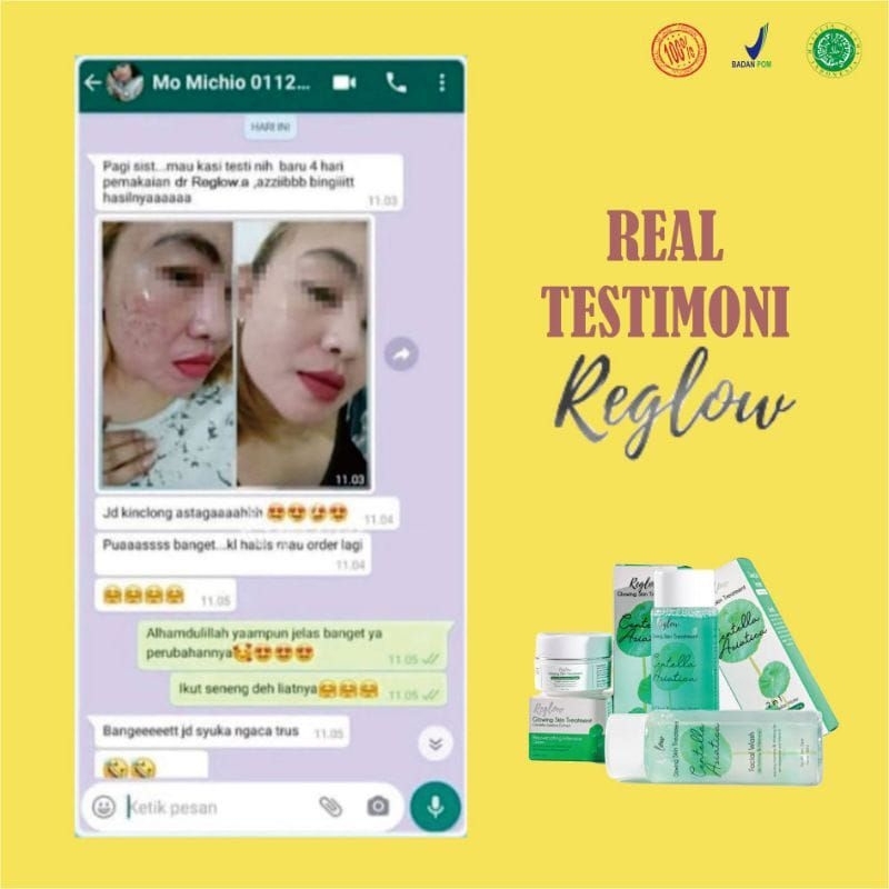 REGLOW Paket Perawatan Kecantikan Wajah Glowing | Glow Skin Treatment | Atasi Muka Jerawat Flek Hitam Milia Kusam | Skincare Skin Care BPOM Halal MUI | Sunscreen Whitening Anti-Aging | Aman Bumil Busui Skincare Reglow / Reglow skincare original dr. shindy