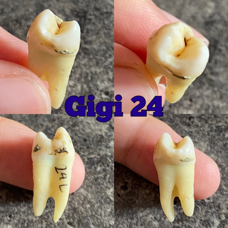 gigi premolar asli manusia