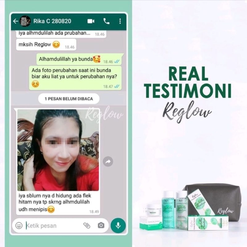 REGLOW Paket Perawatan Kecantikan Wajah Glowing | Glow Skin Treatment | Atasi Muka Jerawat Flek Hitam Milia Kusam | Skincare Skin Care BPOM Halal MUI | Sunscreen Whitening Anti-Aging | Aman Bumil Busui Skincare Reglow / Reglow skincare original dr. shindy