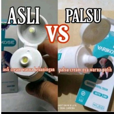 Varikosette original cream perawatan kaki varises