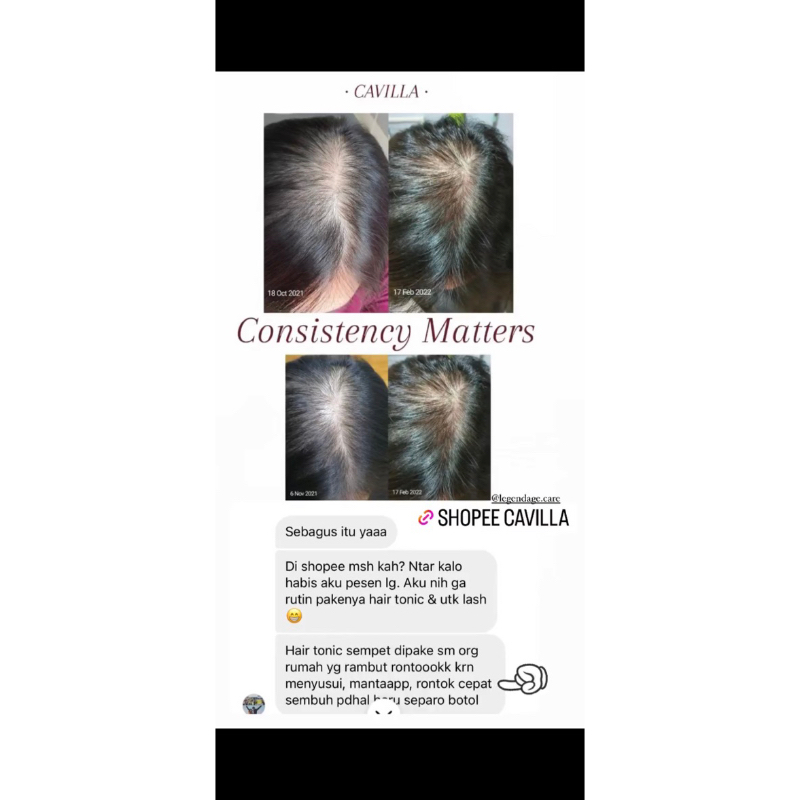 CAVILLA HAIR TONIC PENUMBUH RAMBUT CEPAT ALAMI (100% ORIGINAL)