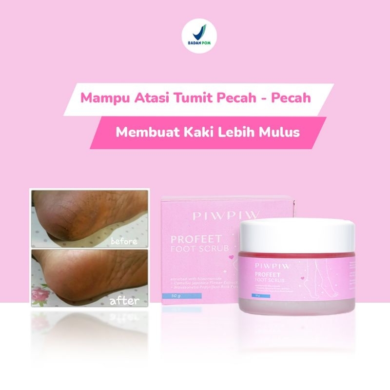 PIW PIW PROFEET FOOT SCRUB MERAWAT KAKI PECAH PECAH EKSFOLIASI KULIT MATI