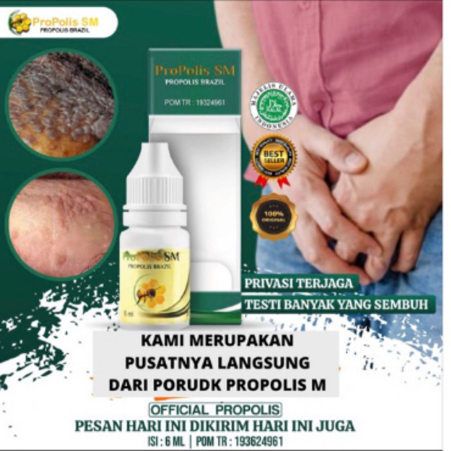 PROPOLIS SM BRAZILIAN ASLI 100% untuk Kutil Kelamin ,Sipilis ,Gonore Kencing Nanah