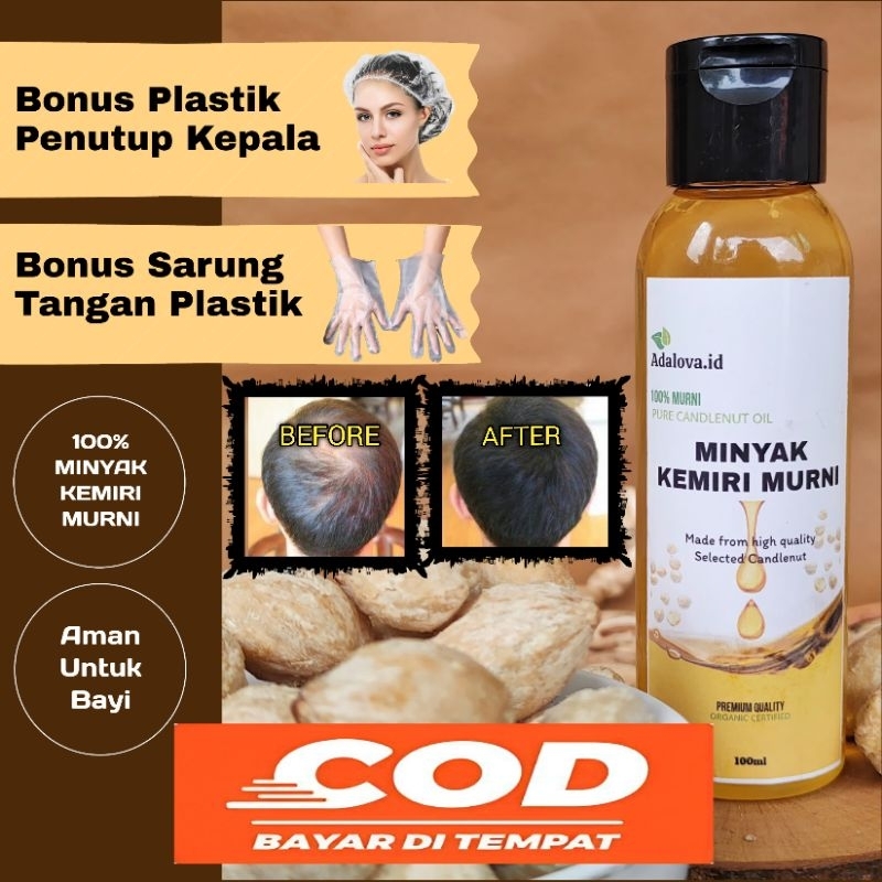 Minyak Kemiri Gold Murni 100ml Penumbuh Rambut Original 100% Asli