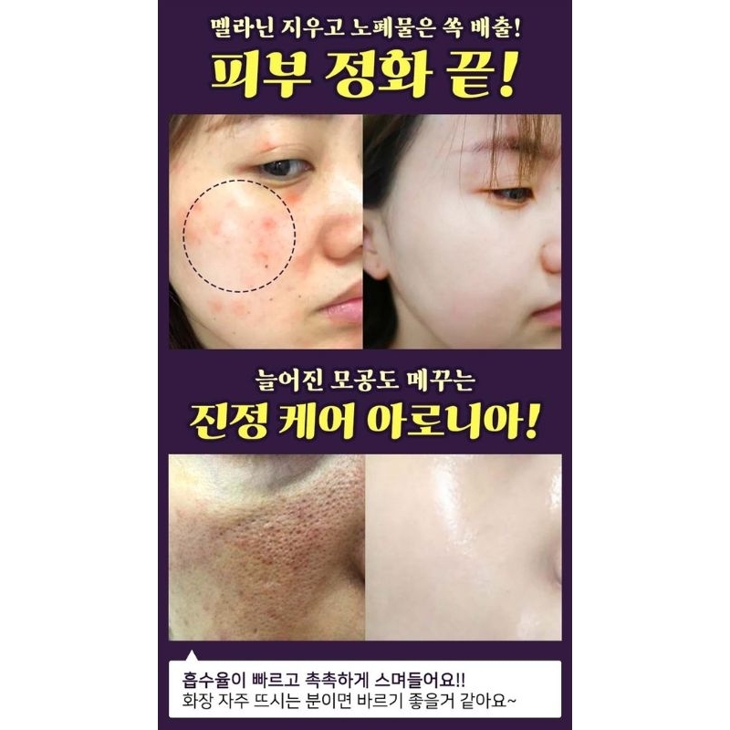 🇰🇷OBAT Flex Hyperpigmentation Whitening HUONS ORIGINAL Ampoule ECERAN 1 PCS