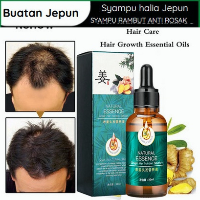 【Only 28 Days】Hair Growth Serum Oil Hair Tonic Hair Growth Shampoo with Ginger Multiflorum Poligonum