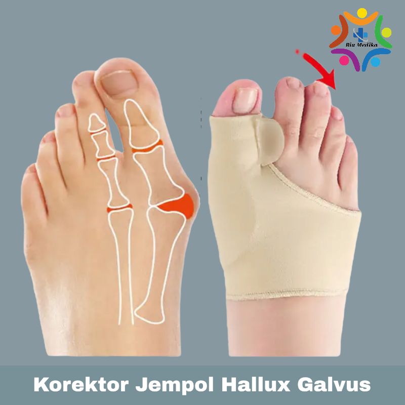 1pcs  Korektor Jempol Kaki Hallux Valgus  Korektor Jari Jempol Kaki