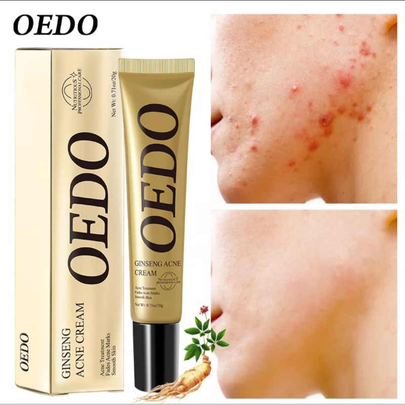 OEDO GINSENG CREAM TREATMENT JERAWAT, MENGHALUSKAN KULIT WAJAH