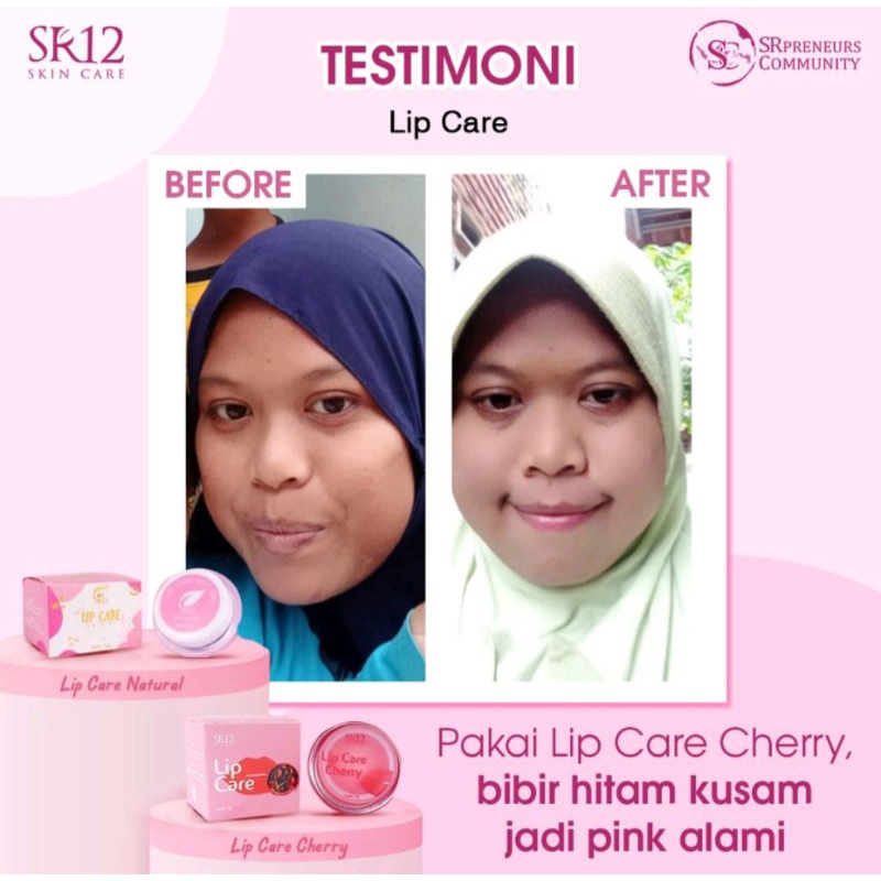 SR12 Lip Care Cherry / Pencerah Bibir SR12 Original BPOM