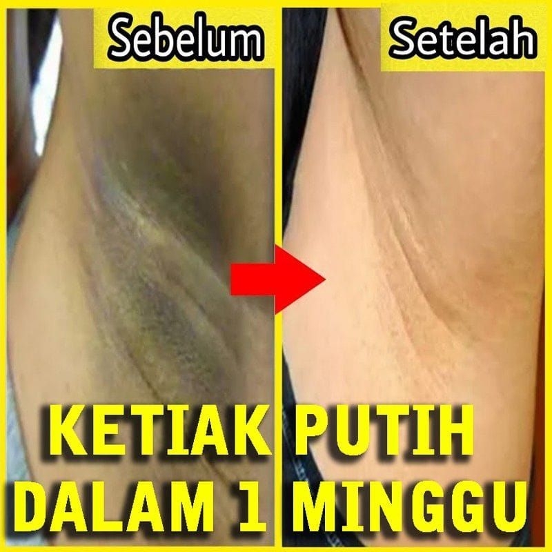 cream lipatan ampuh, cream ketiak hitam, cream ketiak &amp; selangkangan hitam bandel