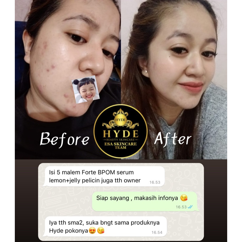 ( FREE MINI GOLD ) HYDE BEAUTY SKINCARE ALL VARIAN ( UNTUK SEMUA JENIS KULIT )