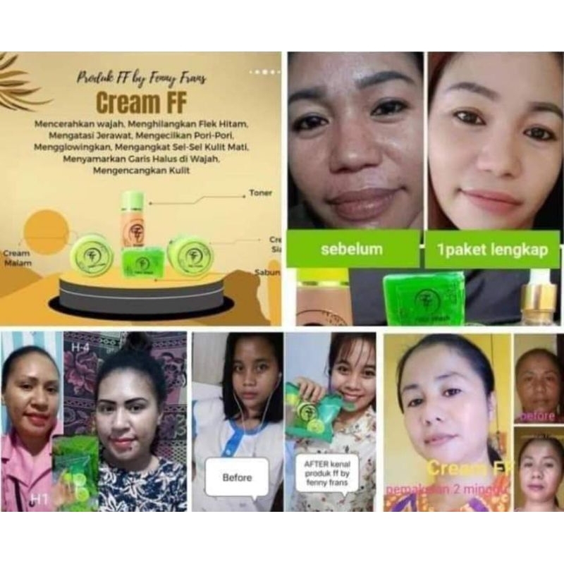 cream ff whitening glowing