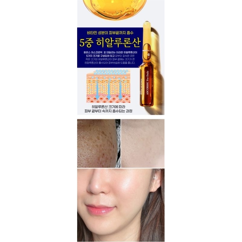 🇰🇷OBAT Flex Hyperpigmentation Whitening HUONS ORIGINAL Ampoule ECERAN 1 PCS