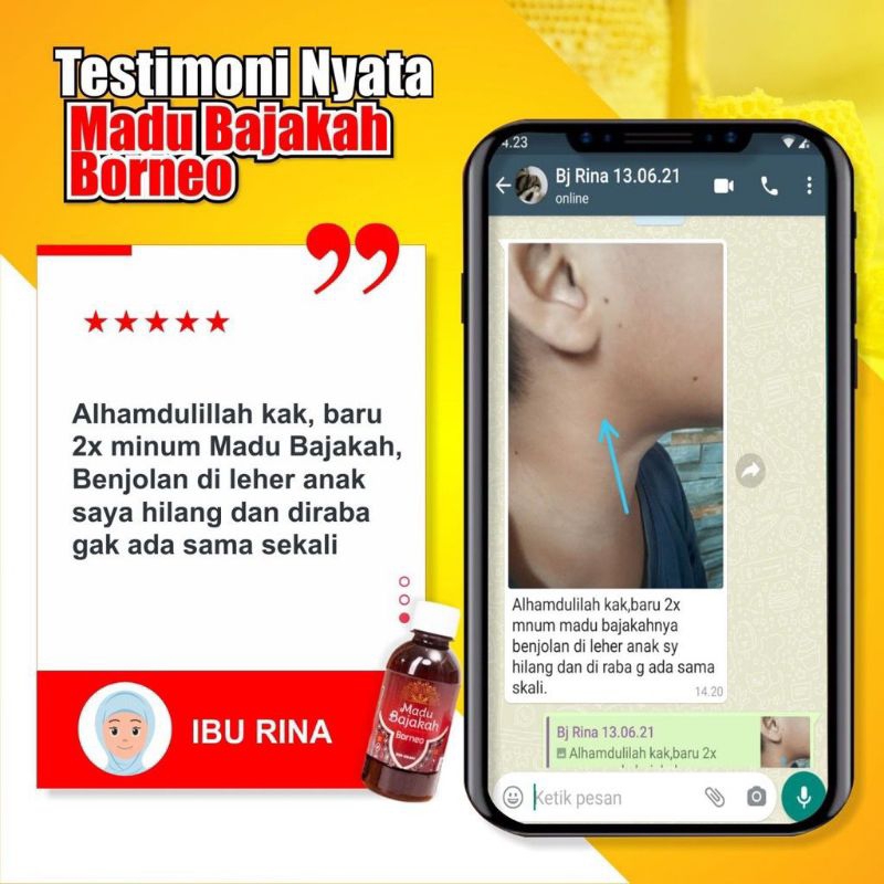 [Garansi 100% Ori] Madu Bajakah Borneo Original Atasi Benjolan Qista Liver Kanker Tumor Kelenjar Jantung Asam Lambung isi 250 gr