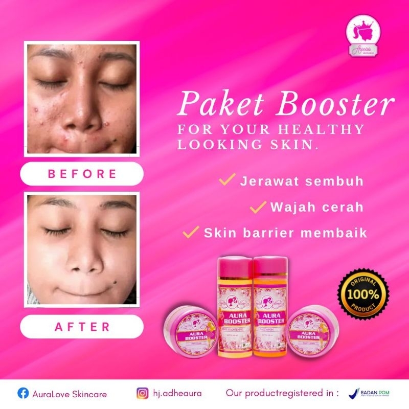 aura skincare paket booster