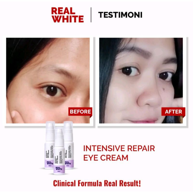 Real White Eye Cream Intensive Repair 20ml