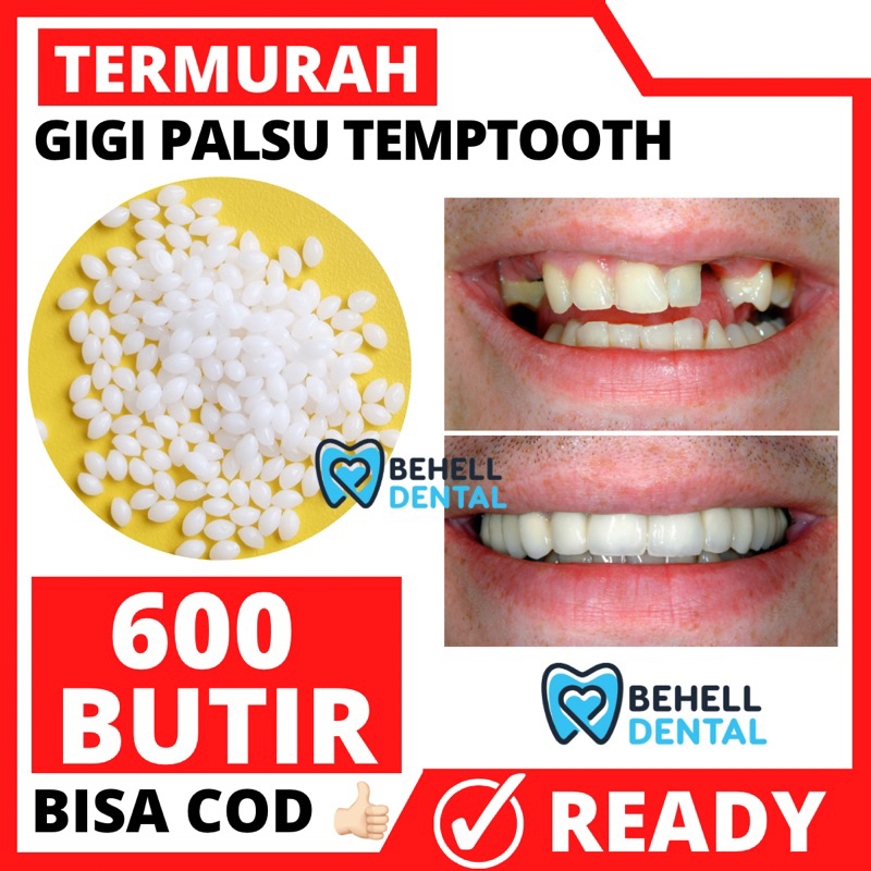 TERMURAH  1000 BUTIR GIGI PALSU TEMPTOOTH PENAMBAL TAMBALAN GIGI PATAH RENGGANG TEMPORARY TOOTH TEMPTOOTH GINGSUL PATAH SEMENTARA - LEM GIGI TIRUAN DENTAL SOLID  ORTHO - 200 BUTIR / 100 BUTIR / 600 BUTIR - BEHELLDENTAL ORIGINAL