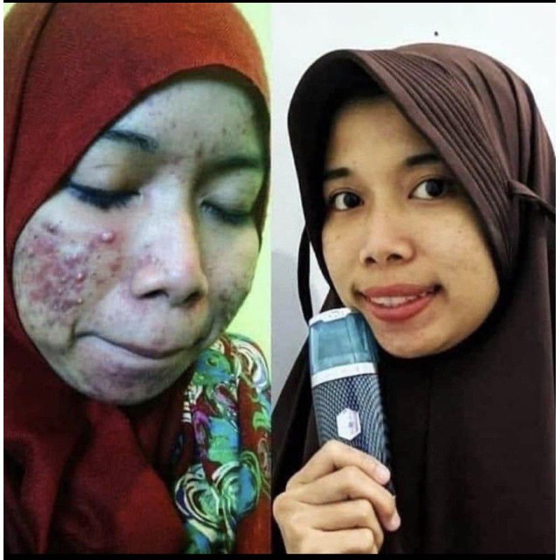 ORIGINAL NANO SPRAY MCI