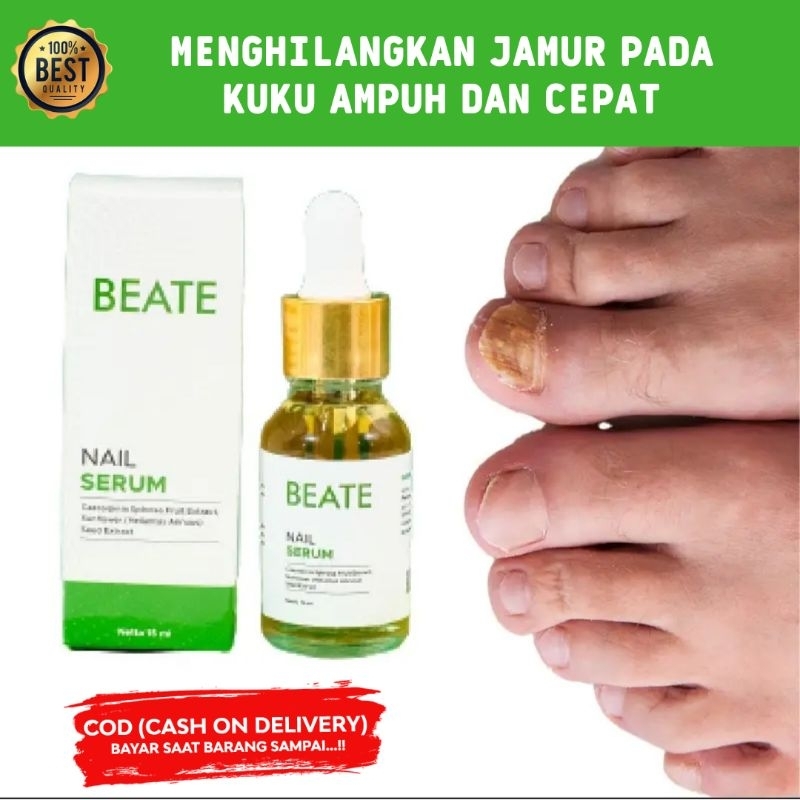 BEATE Serum Kuku Rusak Berjamur Kaki Dan tangan Ampuh / Obat Jamur Kuku Cantengan Bernanah Ampuh