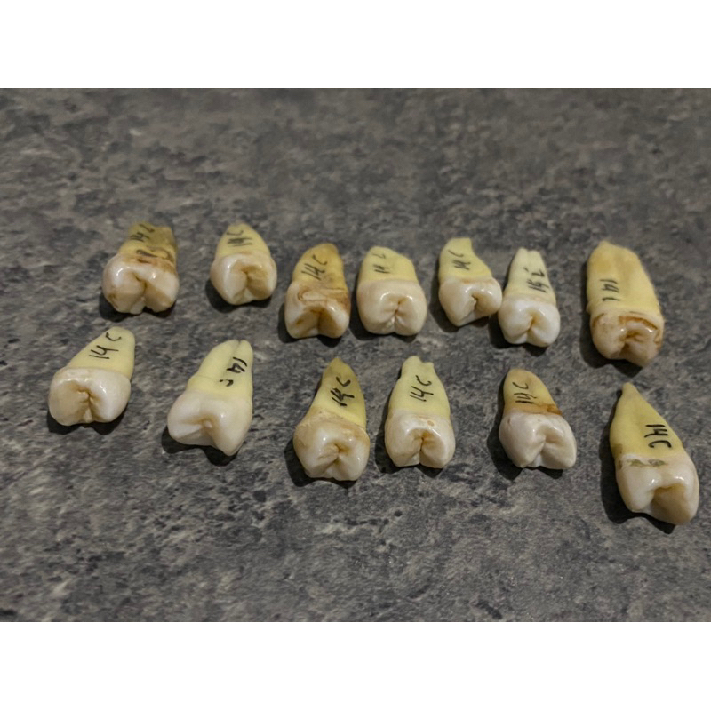 gigi premolar asli manusia