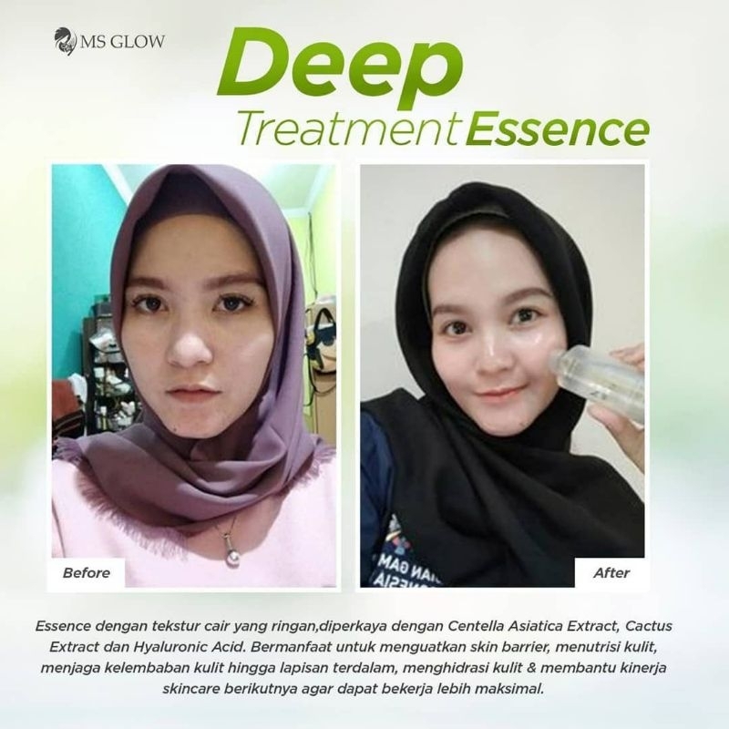 [ 100% ORI ] Deep Treatment Essence MS Glow Original Asli Skin Care Wajah Aman BPOM Halal