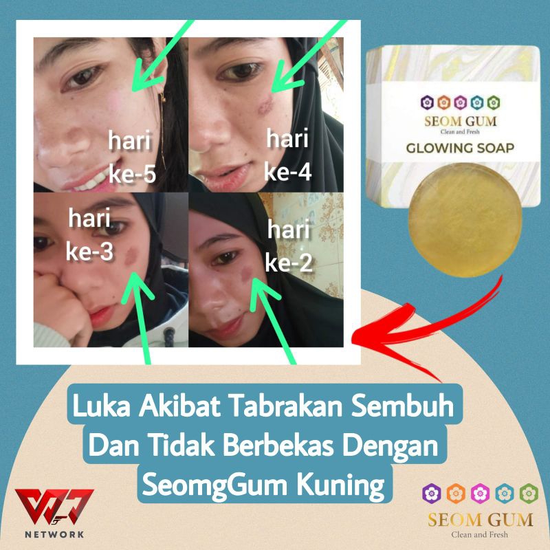 SABUN VIRAL SABUN JERAWAT SABUN FLEK SABUN MISSV SABUN MULTIFUNGSI SABUN KECANTIKAN SABUN KESEHATAN