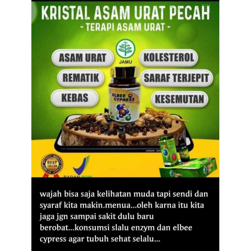 Gigikbunga Elbee Cypress