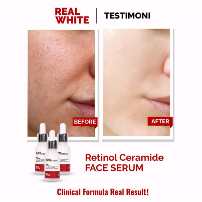 Real White Retinol Ceramide Serum 20ml