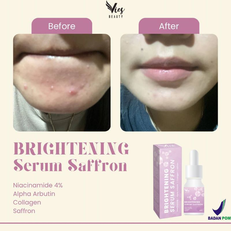 Serum Vies BPOM Kemasan Baru