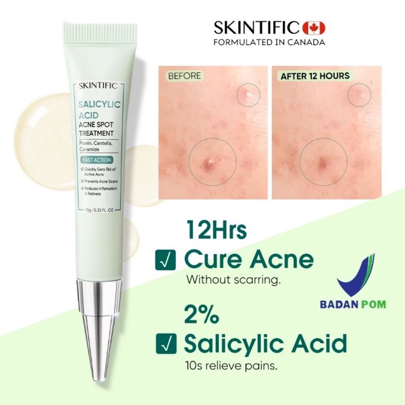 SKINTIFIC Salicylic Acid Acne Spot Treatment Gel Totol Jerawat | Salicylic Acid Anti Acne Serum