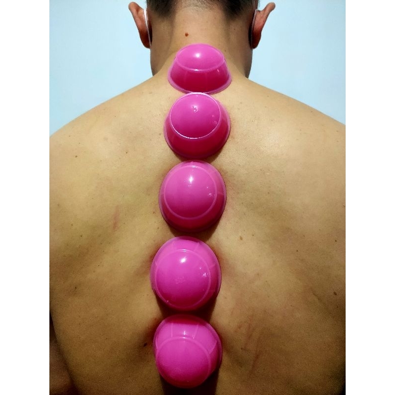 Kop Angin (bekam kering+kerokan) CPB SET ORIGINAL