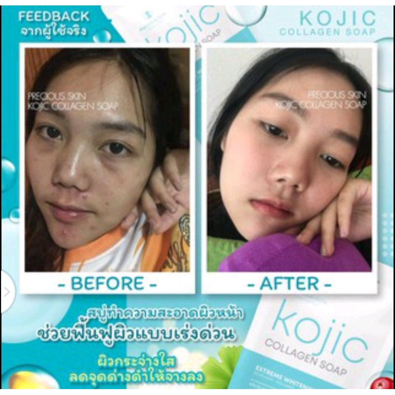 Precious Skin Thailand Kojic Extreme Whitening Collagen Soap / Sabun Colagen / Soap/ Sabun / Pemutih Badan 60