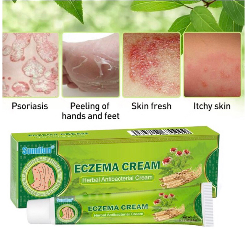 Eczema cream salep anti gatal salep kulit Eksim Dermatitis