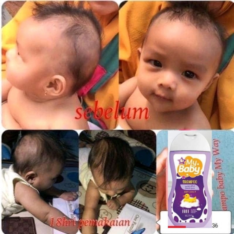 My Baby shampo penumbuh rambut my way import Mesir original // Baby zinc cream my way original