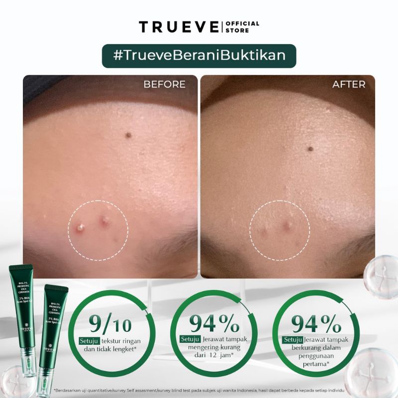 TRUEVE BHA Acne Spot Gel