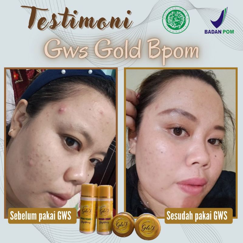 gws skincare