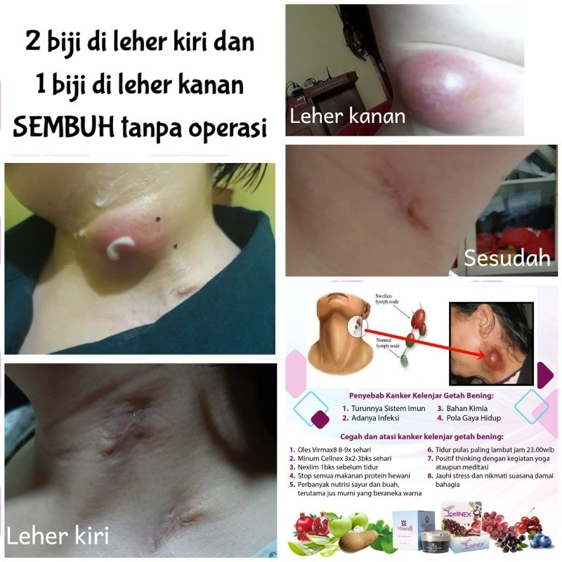 Virmax8 Cream Ajaib, Garansi Original