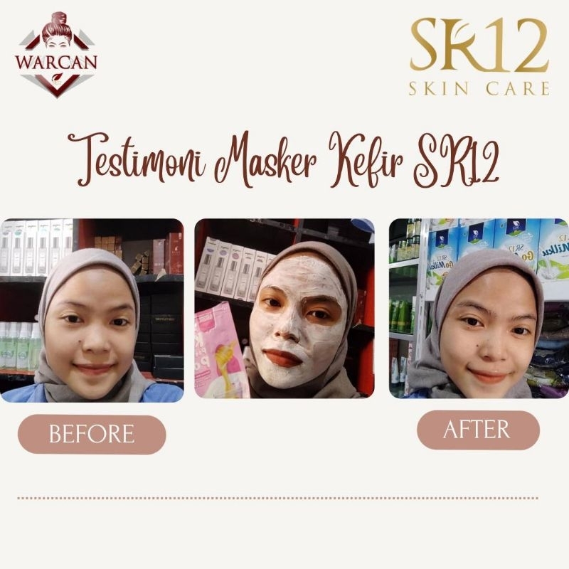 Kefir Peeling Mask Powder Untuk Semua Jenis Kulit