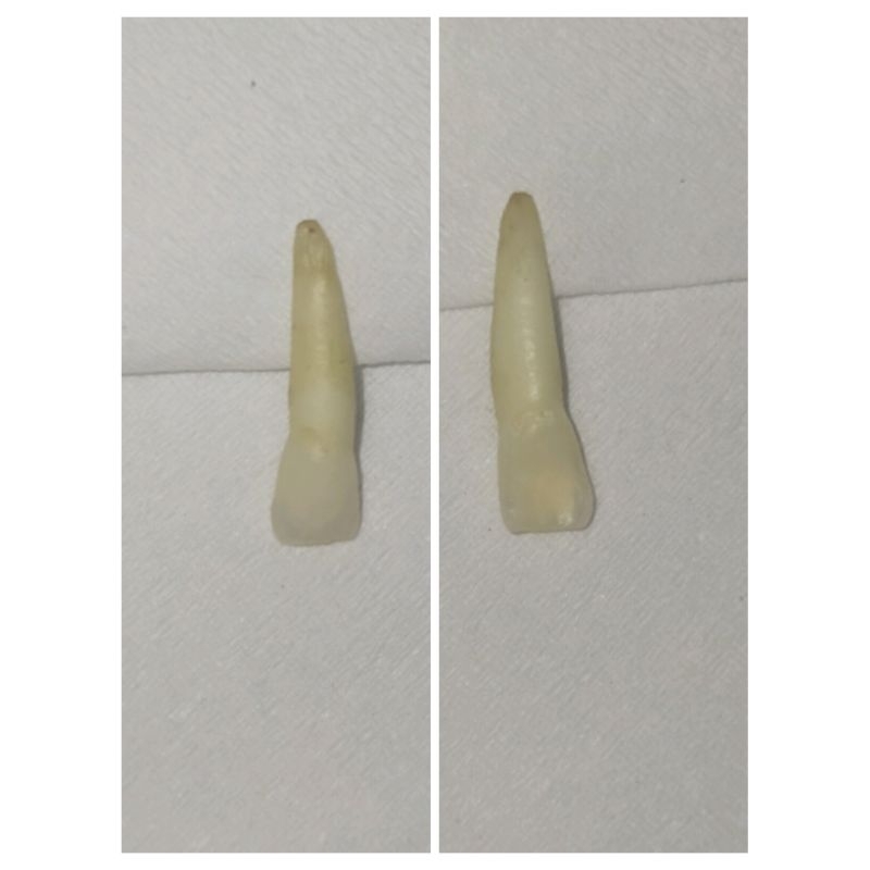 GIGI PRAKTIKUM INSISIVUS ATAS SULUNG/GIGI ASLI PEDO/ GIGI ANAK