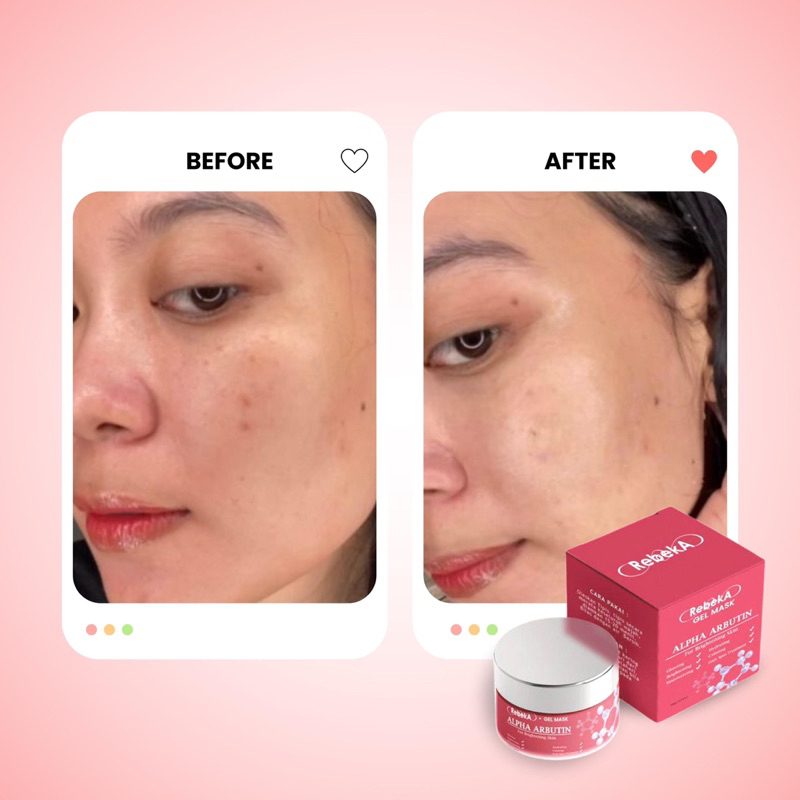 GEL MASK ALPHA ARBUTIN FOR BRIGHTENING SKIN | SLEEPING MASK | REBEKA | BPOM | 30gr | MASKER MENCERAHKAN GLOWING DAN KULIT KERING
