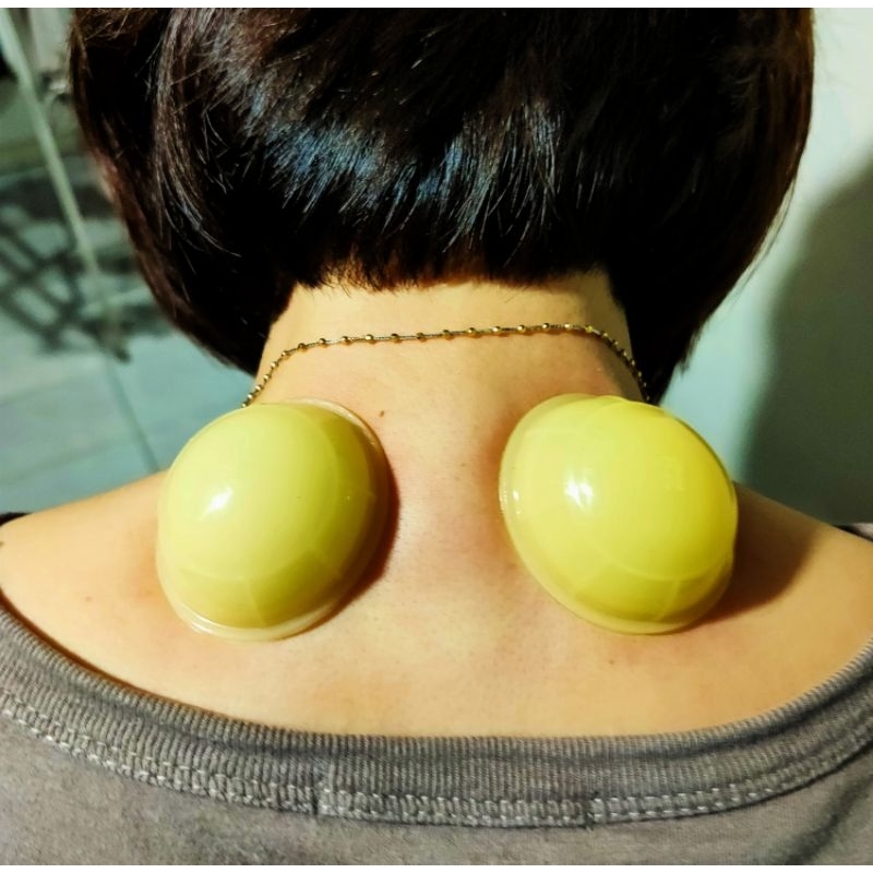 Kop Angin (bekam kering) KOP C ORIGINAL