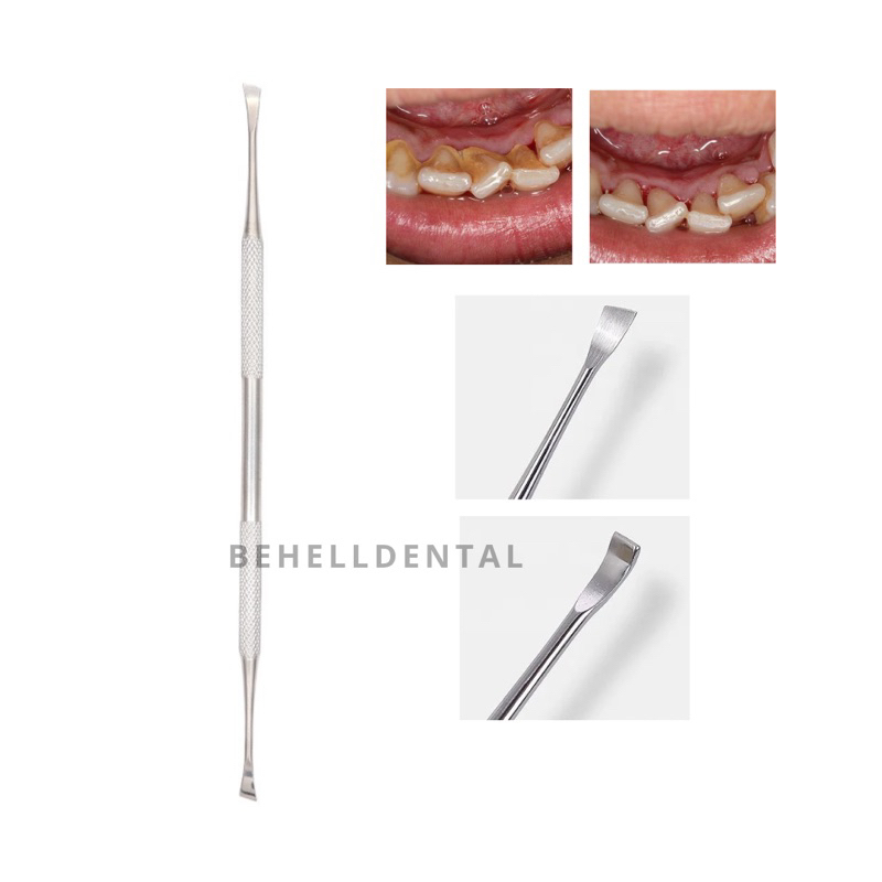 ORI ALAT PENGHILANG KARANG GIGI AMPUH 2 SISI - SCALER SCALLER SCALING ALAT KIKIR KALKULUS KARANG GIGI MANUAL - PENGHILANG PEMBERSIH PLAK MEMBANDEL AMPUH - BEHELLDENTAL