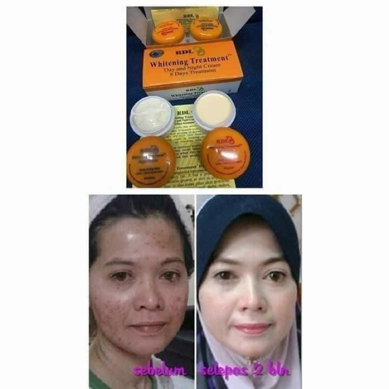 Cream pemutih RDL siang &amp; malam cepet putih