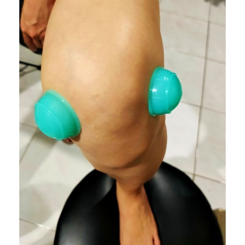 Kop Angin (bekam kering)  KOP D ORIGINAL