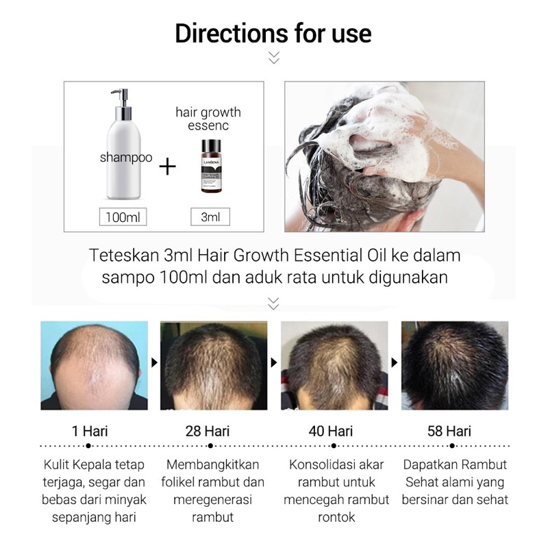 LANBENA Hair Growth Essential Oil - Mencegah Kerontokan Oil Liquid Treatment Preventing Hair Loss Fast Powerful Regeneration